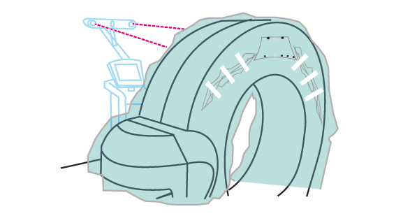 Cubierta estéril para O-Arm ILUMARK