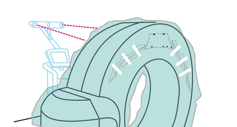 ILUMARK Sterile O-Arm Abdeckung ILUMARK Sterile O-Arm Abdeckung